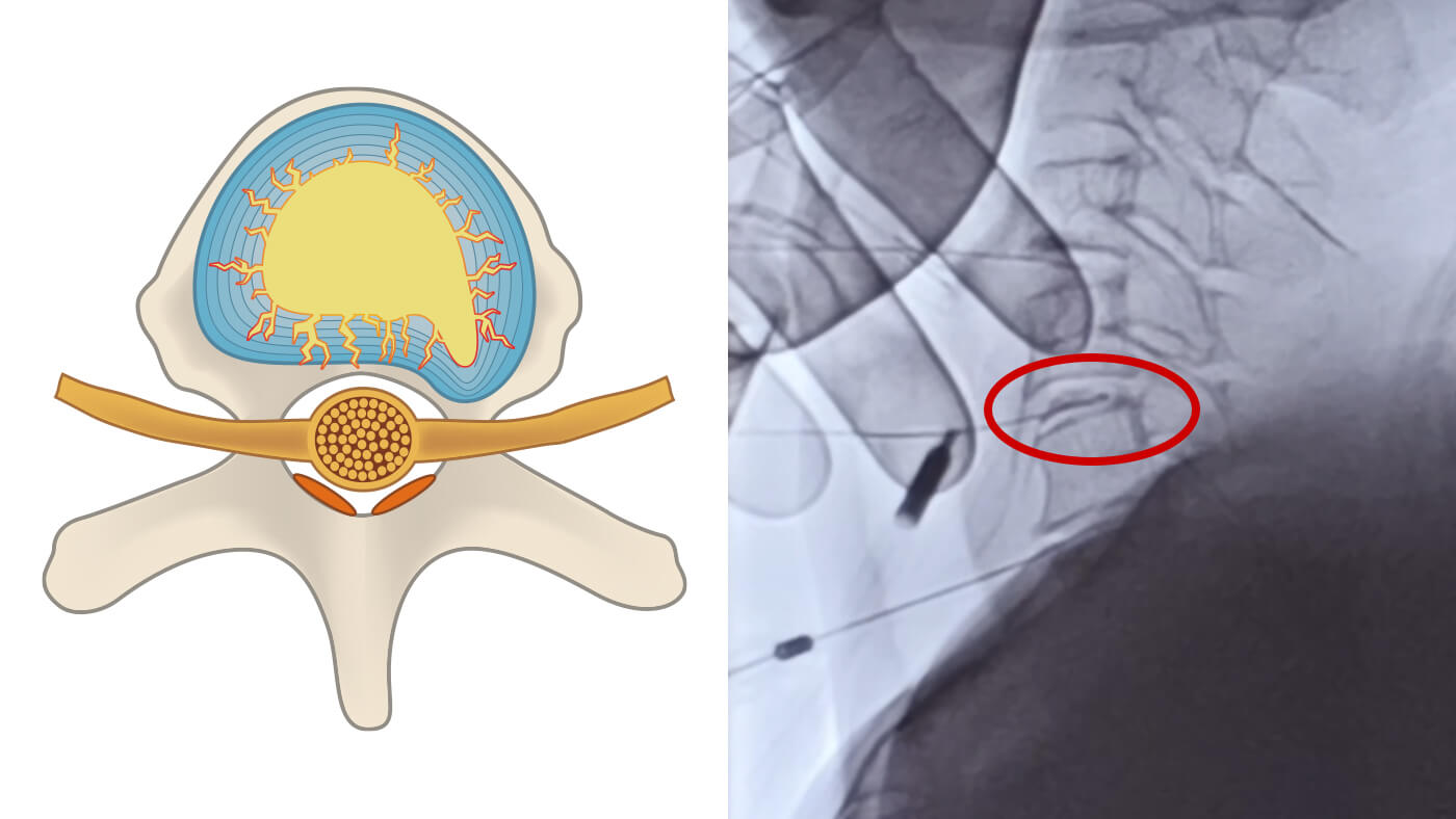 損傷部位の特定の図解