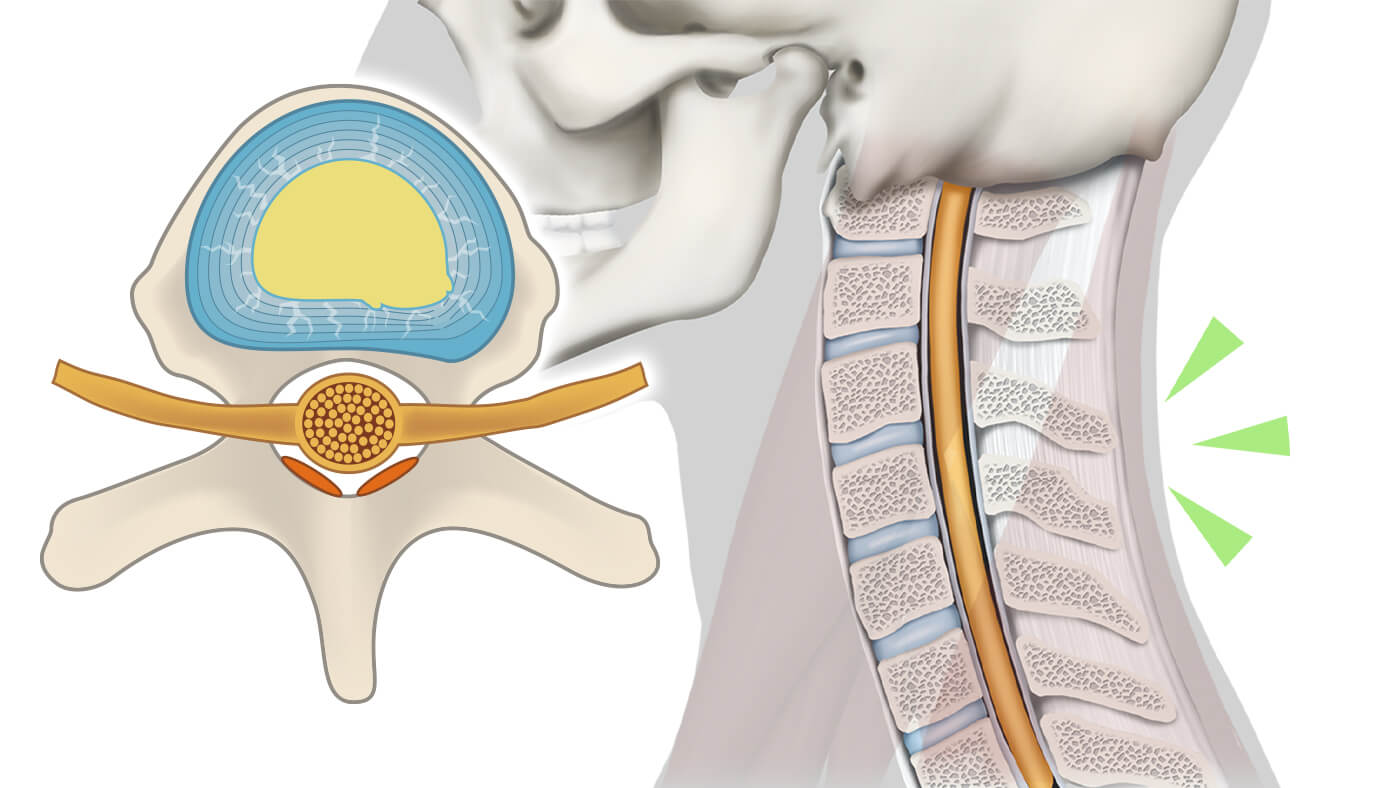 機能回復への期待の図解